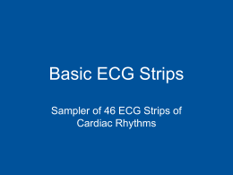 Basic ECG Strips - CSUSAP: Student & Staff Unix Host