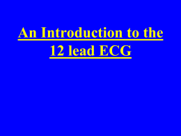 12 Lead ECG Interpretation - Learning