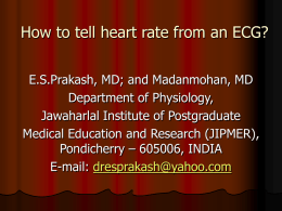 How to tell heart rate from an ECG?