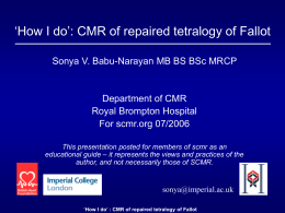 How to do CMR of repaired tetralogy of Fallot