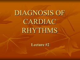 EKG2: dDiagnosis of Cardiac Rhythms