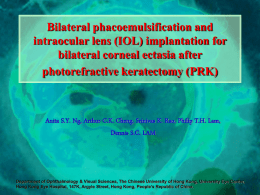 Bilateral phacoemulsification and intraocular lens (IOL