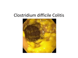 Clostridium difficile Colitis