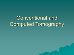Conventional and Computed Tomography