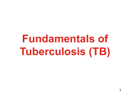 Fundamentals of Tuberculosis (TB)