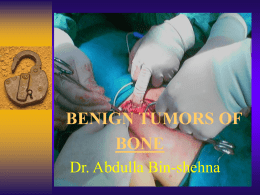 Benign bone tumors