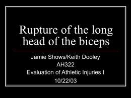 Rupture of the long head of the biceps