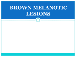 Mucosal Melanotic Macule