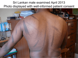 Sri Lankan male examined April 2013 Photo displayed with