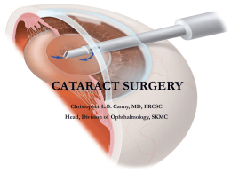 Cataract Surgery and coding.pps
