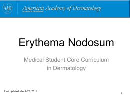 Erythema Nodosum - American Academy of Dermatology