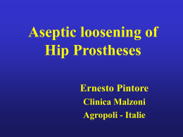 Aseptic loosening of Hip Prostheses