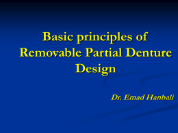 Basic principles of Removable Partial Denture Design