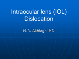 IOL dislocation