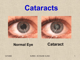 The Effects of Antioxidant Vitamins on Cataract