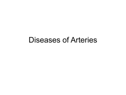 Diseases of Arteries