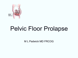Pelvic Floor Prolapse - Malcolm Padwick MD, FRCOG