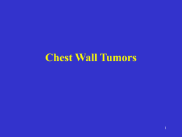 Chest Wall Tumor