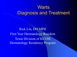 Warts Diagnosis and Treatment