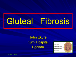 Gluteal Fibrosis: - Kumi Hospital Uganda