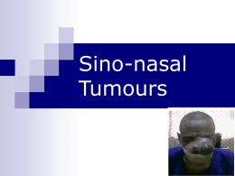 Nose_Sino-nasal Malignancies