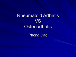 Rheumatoid Arthritis VS Osteoarthritis