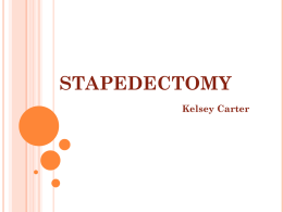 stapedectomy