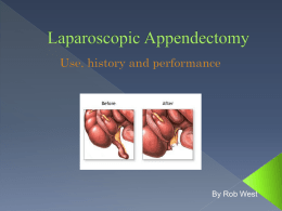 Laparoscopic Appendectomy.
