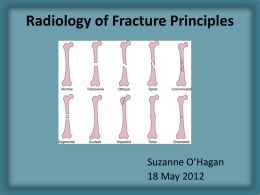 Recognizing an acute fracture - Learning