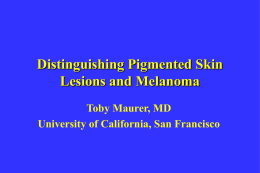 Distinguishing Melanoma from other Pigmented Lesions