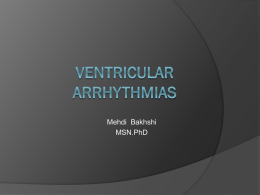 Ventricular arrhythmia