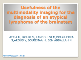 Usefulness of the multimodality imaging for the diagnosis