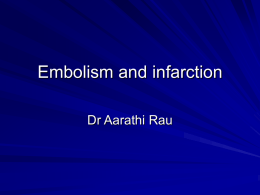 Embolism and infarction - Welcome to nky.wikidot.com