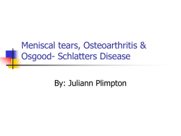 Meniscal tears, Osteoarthritis & Osgood