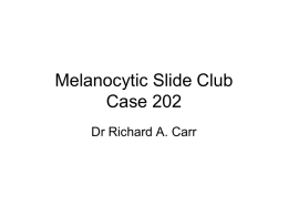 Melanocytic Slide Club Case 201
