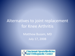 Alternatives to joint replacement for Knee Arthritis
