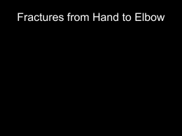 Fractures hand to elbow