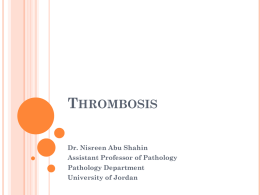 Thrombosis - JUdoctors