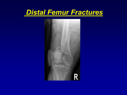 DISTAL FEMUR FRACTURES - Orthopaedic Trauma Association