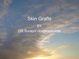 Skin Grafts & Flaps
