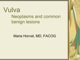 Vulva Neoplasms and common benign lesions