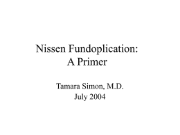 Nissen Fundoplication: A Primer