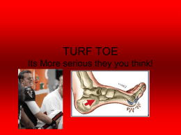 TURF TOE Its More serious they you think!