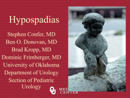 Hypospadias - OU Medicine