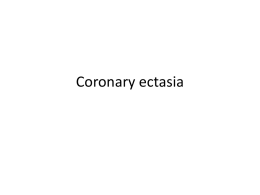 Coronary ectasia