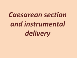 Caesarean section and instrumental delivery