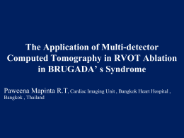 The Role of MDCT scan in RVOT Ablation in BRUGADA’ s Syndrome