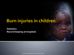 Burn injuries in children