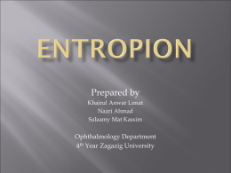 ENTROPION - zu.edu.eg