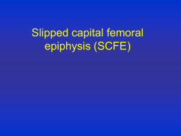 Slipped capital femoral epiphysis (SCFE)